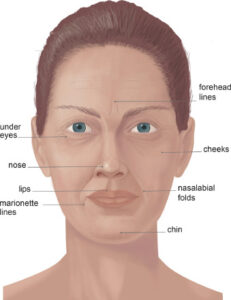 Facial cosmetic surgery