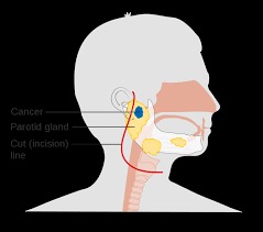 Salivary Gland Surgery